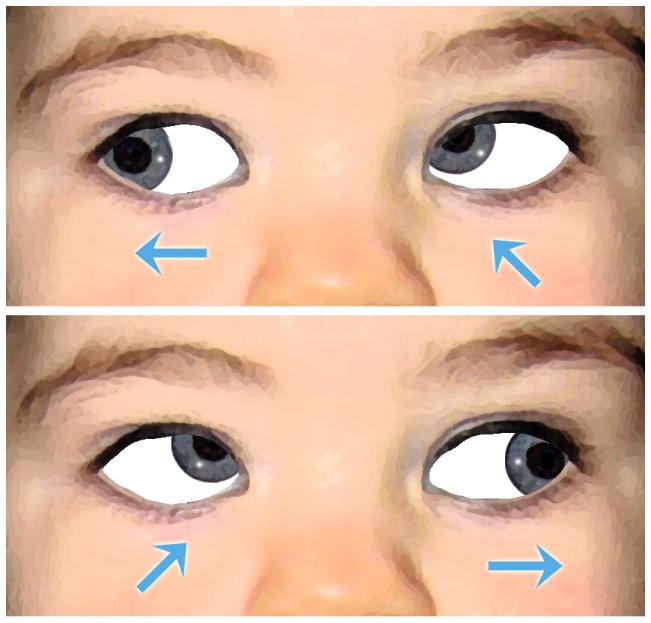 inferior oblique eye movement